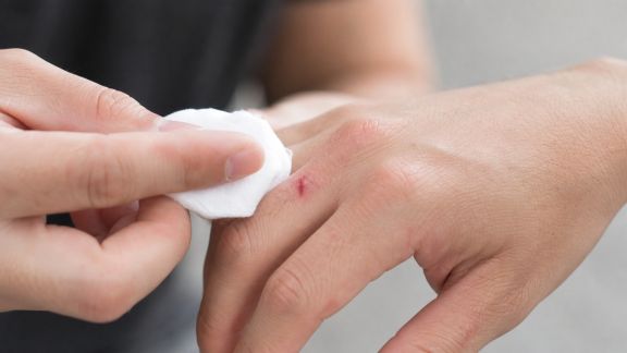 Petites blessures et infections : comment éviter l’aggravation